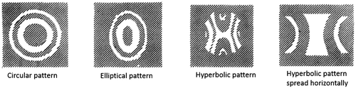 Figure 11. Diffraction patterns of a point source as a result of rotating a circular pupil about vertical axis. Source: Weale 1956, reproduced with permission from British Journal of Ophthalmology.