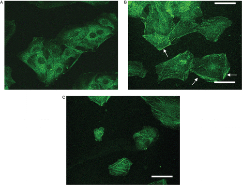 Figure 5.  Confocal photographs of PMC on PMA-induced PKC-α translocation in vascular smooth muscle cells. VSMCs (1 × 105 cells/coverslip) were (A) untreated, or treated with (B) isovolumetric solvent control (0.1% DMSO), and (C) PMC (50 μM), followed by the addition of PMA (1 μM). Confocal images are typical of those obtained in three separate experiments demonstrating the distribution of PKC-α (arrows) in VSMCs. The white bar indicates 50 μm.