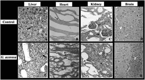 Figure 13. Histopathological analysis of the effect of G. acerosa on mice treated with 2000 mg/kg bw. A, B, C & D – Control group; E, F, G, H – G. acerosa-treated group. A&E- Display full size Liver section showing normal hepatocyte architecture without any necrosis. B&F- Display full size Heart muscles showing intact fibre alignment with normal tissue integrity. C&G- Display full size Kidney sections showing normal tubules and interstitium. D&H- Display full size Brain section with normal marginal alignment and interneuronal space.