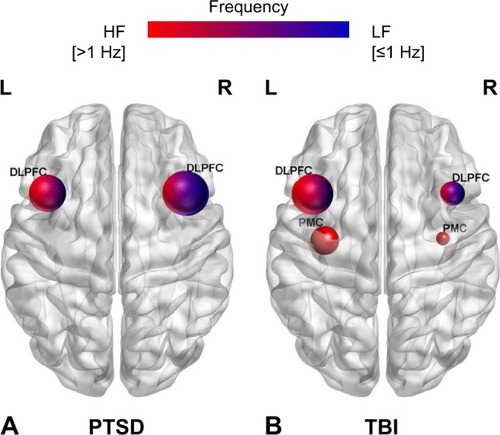Figure 1 Schematic representation of the target brain regions according to frequency of rTMS among trauma-exposed individuals in the review: (A) PTSD patients and (B) TBI patients.
