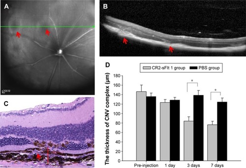 Figure 2 CNV model (A–C) and therapeutic assessment of CR2-sFlt 1 (D).