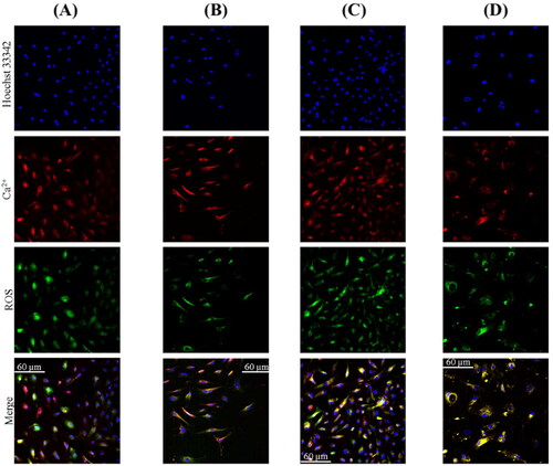 Figure 4. Triple fluorescence study of LECs from internal surface trypan blue stained anterior lens capsule in a patient with age-related cataract (A); LECs from internal surface trypan blue stained anterior lens capsule in a type 2 diabetic cataract patient (B); LECs from outer surface trypan blue stained anterior lens capsule in a patient with age-related cataract (C); LECs from outer surface trypan blue stained anterior lens capsule in a type 2 diabetic cataract patient (D).