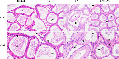 Figure 2 Effects of LYC on post-LPS epididymis histopathology at 100 and 200 times. Compared with the Control (A, E) and Oil (B, F) groups, evident edema between the tubules and interval widening were present in the epididymis of the LPS-treated group (C), disordered and irregular epithelial cells, and a lower concentration of sperm in the lumen (G). LYC-treatment reduced edema (D) and significantly improved the shape of the lumen and the quantity of sperm in it (H).