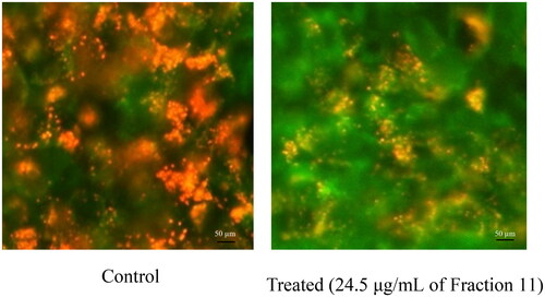 Figure 7. JC-1 green fluorescence ratio signals in SK-BR3 cells with and without treatment with Fraction 11. Note: SK-BR3 human breast cancer cells were treated with 24.5 μmol/L of Fraction 11 for 24 h. Images were captured with a 40× objective on an inverted imaging system.