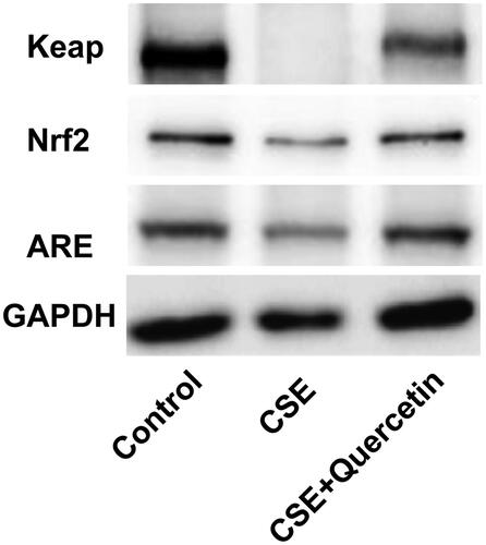 Figure 5. Effects of treatment with Quercetin on the expression levels of Keap1/Nrf2/ARE pathway in different groups.