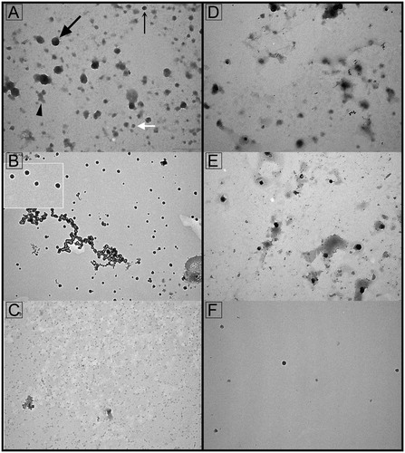Figure 1. Transmission electron microscopy of seminal prostasomes from normozoospermic men separated by lectin-affinity chromatography. Micrographs of vesicles (70–170 nm) in a concanavalin A (Con A)-non-bound fraction (A). A dense vesicle (thin arrow), a dark vesicle (thick arrow), a light vesicle (white arrow), and amorphous material (arrowhead) can be clearly observed. Single (50–90 nm) or aggregated vesicles were present in a Con A-bound fraction (B). The insert shows the typical cup-shape appearance enlarged. Micrographs of vesicles (50–100 nm) in wheat germ agglutinin (WGA)-non-bound fraction (D) and vesicles (50–100 nm) in a WGA-bound fraction (E). Vesicles in the high-pH-eluted fraction from Con A column (C) and low-pH-eluted fraction from WGA column (F) were scarce.