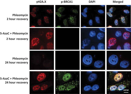 Figure 5. Influence of 5-AzaC on BRCA1 recruitment and DNA repair. PC-3 cells were grown on chamber slides, either pre-treated with 5-azacytidine or left untreated, then treated with phleomycin for 1 h and left to recover for 2 or 24 h. Cells were then fixed and probed for p-BRCA1 (ser1423) and γH2A.X via immunofluorescence staining.