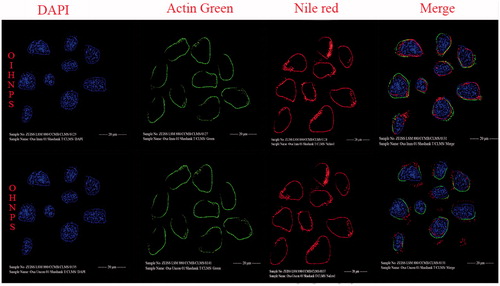 Figure 12. Fluorescent images of hybrid nanoparticles loaded with three fluorescence dyes in cell. In vitro fluorescence images of HT-29 cells (TRAIL-positive) after incubation with OIHNPs-(Nile red)-DAPI-Actin green and OHNPs-(Nile red)-DAPI-Actin green for 1, 3, 5 or 7 h to measure intracellular drug release profiles. Initial first row (vertical) represents nuclei stained with DAPI, which was followed by an second row of actin filaments and third row of nile red nanoparticles that circumvents the nuclei in the fourth row (vertical).