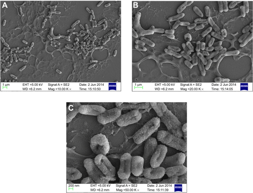 Figure S5 Scanning electron micrograph of PBSNPs-treated Pseudomonas aeruginosa PAO1 at different magnifications (A) 5,000×, (B) 10,000×, and (C) 50,000×.Abbreviation: PBSNPs, polymyxin B-capped silver nanoparticles.