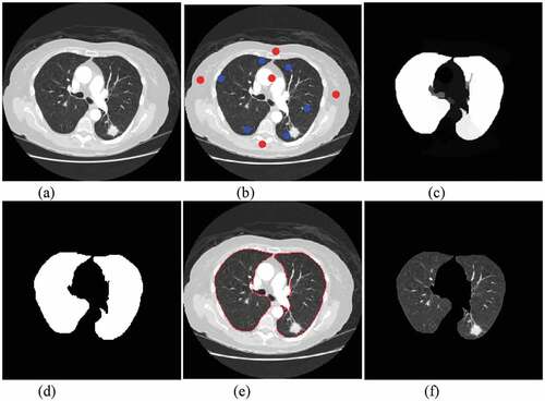 Figure 2. Pulmonary parenchymal segmentation: (a)original image. (b) front and background seed settings (c) front probability calculation (d) binarization (e) segmentation boundary (f) pulmonary parenchymal segmentation.