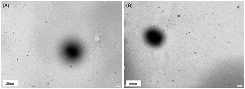 Figure 2. Transmission electron micrograph (TEM) of (A) nanoemulsion gel (placebo-NE gel) and (B) amphotericin B loaded nanoemulsio gel (AmB-NE gel).