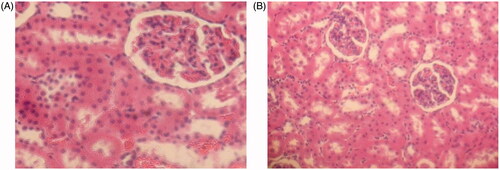 Figure 4. Histology images of rat kidney tissue. (A) 100 mg/mL; (B) 500 mg/mL.