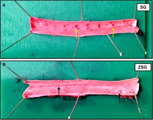 Figure 22 Photographs of thoracic aorta stained with Sudan IV dye (sudanophilia) illustrate the effects of ZER and SIM treatment on atherosclerotic fatty streak development and establishment.