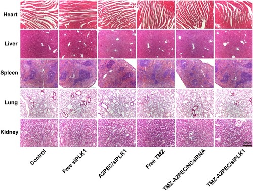 Figure 9 H&E staining of heart, liver, spleen, lung, and kidney of the U87-Luci tumor-bearing mice treated with PBS, free siPLK1, A2PEC/siPLK1, free TMZ, TMZ-A2PEC/NCsiRNA, TMZ-A2PEC/siPLK1 at the dose of siPLK1 is 1 mg kg−1 (scale bar = 200 µm).