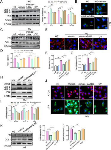 Figure 6 MiR-204-5p overexpression ameliorates HG-induced fibronectin and collagen I expressions by restoring autophagy in HK-2 cells. (A) The expression of LC3, P62, and ATG5 was measured using Western blot analysis. (B). Immunofluorescence was performed to detect the expression of LC3 (scale bar = 25μm). (C and D). The expression of FN and COL I was measured using Western blot analysis. (E). Immunofluorescence was performed to detect the expression of FN (scale bar = 25μm). (F) The concentrations of FN in the culture media of HK-2 cells were evaluated using ELISA. (G) The relative mRNA expression of FN was measured using qRT-PCR. (H and I). The expression of ATG5, LC3, and P62 was measured using Western blot analysis. (J). Immunofluorescence was performed to detect the expression of ATG5 and LC3 (scale bar = 25μm). (K) The expression of FN and COL I was measured using Western blot analysis. **p < 0.01.