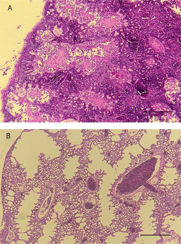 Figure 4  Photomicrographs of nestling lung tissue A, Tissue from chick 42499 showing poor lung aeration, congestion and accumulation of proteinaceous fluid in the airways. B, Tissue from chick 42843 with ventriculitis and showing good lung aeration. (Bars = 400 µm) (H&E stain).