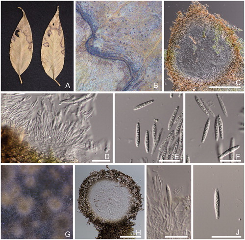 Figure 2. Morphological features of Botryosphaeria tenuispora [A–F: MUMH 10420 (MUCC 237) and G–I: MUCC 2900]. (A) Specimen MUMH 10420. (B) Symptoms with pycnidia forming on the leaf of Leucothoe fontanesiana. (C) Vertical section of pycnidium in the leaf tissue. (D) Conidia and conidiophores. (E, F) Conidia. (G) Conidiomata formation on BMA after 7 days. (H) Conidiomata. (I) Conidium and conidiophores. (J) Conidium. Scale bars, 200 μm (C and H) and 25 μm (D–F and I–J).