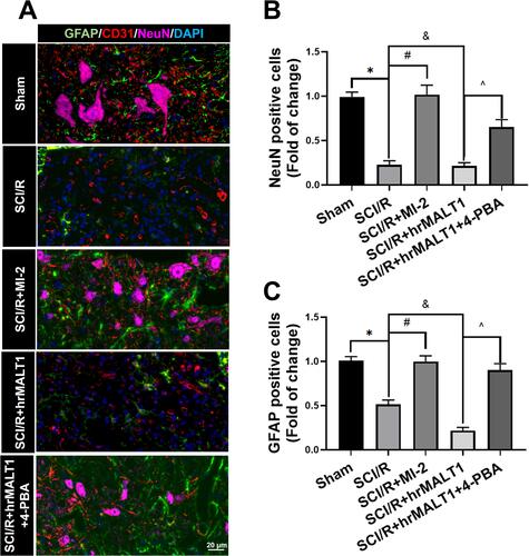 Figure 8 Evaluation of the neurovascular units in spinal cord. (A) The neurons, astrocytes and endothelial cells co-localization in spinal cord anterior horn were detected by triple immunofluorescent staining. Scale bar = 20 μm. (B, C) The number of NeuN and/or GFAP positivities was quantitatively analyzed. Data are presented as the mean ± SEM. n = 6 per group. *P < 0.05 vs sham group, #P < 0.05 vs SCI/R group, &P < 0.05 vs SCI/R group, ^P < 0.05 vs SCI/R + hrMALT1 group.