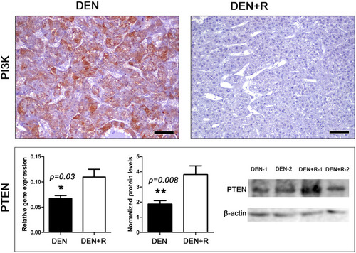 Figure 5 Romidepsin treatment ablates PI3K and upregulates PTEN expression in HCC. HCC from non-treated mouse shows able cytoplasmic PI3K expression. By contrast, PI3K immunohistochemical signal in HCC from Romidepsin-treated mouse is practically non-detectable. The treatment up-regulated PTEN expression as determined by both Real-time PCR and Western blot analyses. Western Blot from two selected liver samples per experimental group, also used in Figures 3 and 4, is presented. IHC; Diaminobenzidine chromogen, Hematoxylin counterstain. Scale bars: 25 μm. Numbers on the y-axis of bar graphs correspond to the mean±SEM of the parameters assessed. *p<0.05, ** p<0.001.Abbreviations: DEN, diethylnitrosamine; PI3K, phosphoinositide-3-kinase regulatory subunit 1; PTEN, phosphatase and tensin homolog; R, Romidepsin.