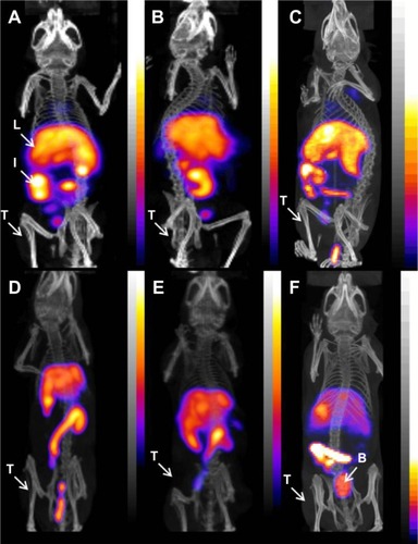 Figure 4 Micro-SPECT/CT images of U-87 MG tumor-xenografted SCID mice after intravenous injection of 111In-labeled liposomal nanoparticles: (A) RLP, (B) Hybrid-LP, and (C) NoTarget-LP 4 hours after administration; (D) RLP, (E) Hybrid-LP, and (F) NoTarget-LP at 24 hours post-injection (RLP, n=1; Hybrid-LP, n=1; NoTarget-LP, n=1).Abbreviations: 111In, indium-111; B, bladder; Hybrid-LP, liposomal nanoparticle carrying an RGD and SP building block; I, intestine; L, liver; LP, liposome; NoTarget-LP, liposomal nanoparticle with no targeting sequence; RGD, arginine-glycine-aspartic acid; RLP, liposomal nanoparticle carrying an RGD building block; SCID, severe combined immunodeficiency; SP, substance P; SPECT/CT, single photon emission computed tomography/computed tomography; T, tumor.