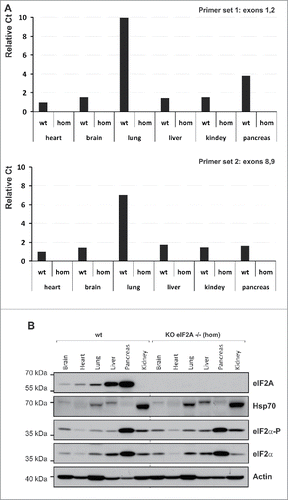 Figure 2. The eIF2A gene expression. (A) Real-time PCR. Relative Ct values are shown; Ct values were normalized to gapdh signal and are shown relative to wild-type brain sample. Two sets of primers were used: Primer set 1, recognizing sequences within exons 1 and 2 (top) and primer set 2 recognizing sequences within exons 8 and 9 (bottom). (B) Western blotting. mRNA and protein levels were analyzed in 6 different mouse tissues heart, brain, lung, liver, kidney and pancreas, respectively.