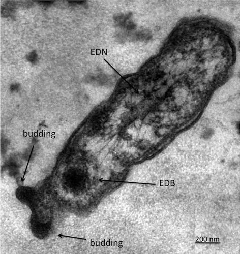 Figure 1 Ultrathin section of a transduced bacterial cell (E. coli AB1157) in the process of budding. EDB: Electron dense bodies, EDN: Electron dense network.