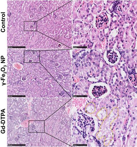 Figure 3 Histopathological images of kidney tissue staining with HE. The right collum was the magnified area of the rectangle box in left collum. Scale bar in left is 250 μm, and scale bar in right is 50 μm. The dot lines circled some typical cytoplasmic vacuoles.