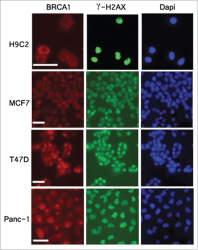 Figure 4. Cytoplasmic localization of BRCA1 in H9C2 cardiomyocytes. Cells were exposed to 5 Gy of X-ray and subjected to immunofluorescent analysis 1 hour after irradiation with anti- BRCA1 (red), γH2AX (green) antibodies. Nuclei were stained with DAPI (blue). Scale bar, 50 um.