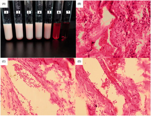 Figure 7. Safety tests for ETM-ILE: (A) In vitro hemolysis test for ETM-ILE, tubes 1–5 were experimental group, tube 6 was the negative control, and tube 7 was the positive control; Images of the pathological sections of rabbit ear at the site of administration (HE staining, 200× magnification) of the three groups: ETM-SOL group (B), ETM-ILE group (C), and Normal saline group (D).