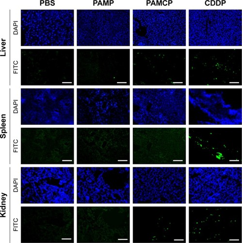 Figure 5 The detection of liver, spleen, and kidney apoptosis.Notes: Apoptotic cells in different organs were detected with the TUNEL assay (green). The cell nuclei were stained using DAPI (blue). Scale bar is 200 µm. P8, peptide with sequence CHAIYPRH.Abbreviations: CDDP, cisplatin; DAPI, 4’,6-diamidino-2-phenylindole; FITC, fluorescein isothiocyanate; PAMP, PGA-Asp–maleimide-P8; PAMCP, PGA–Asp–maleimide– cisplatin–peptide complex; PGA, poly-γ-glutamic acid.