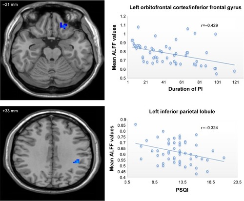 Figure 2 Scatter plot of the mean ALFF values in the left orbitofrontal cortex/inferior frontal gyrus and left inferior frontal gyrus changing with the duration of PI and PSQI, respectively.