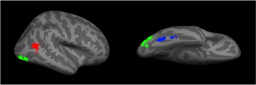 Figure 2 A representation of the core face network – including the fusiform face area (blue), the occipital face area (green), and the posterior superior temporal sulcus (red).