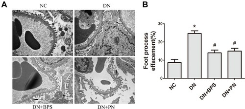 Figure 4 Effects of PN treatment on renal podocyte foot process effacement in STZ-induced diabetic rats. Representative electron photomicrographs from each group of rats (A) (magniﬁcation 13500×). Quantitative analysis of density of podocyte foot processes (B).