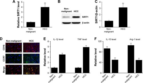 Figure 1 SIRT1 upregulation was correlated with M1-like macrophage density in HCC tissues.Notes: (A) The expression of SIRT1 in paired non-malignant tissues and primary HCC tumor tissue was determined by qRT-PCR. (B, C) Representative immunoblots (B) and quantitative assessment of SIRT1 (C) in normal hepatic tissue (Con) as well as primary HCC tissue. (D) Immunofluorescence staining of M1 macrophage marker CD16 (red) and CCR7 (green) in normal liver tissue (Con) and primary HCC tissue. DAPI (blue) was used for nuclei staining. Scale bar, 10 µm. (E, F) M1 markers and M2 markers were determined by qRT-PCR. Results are displayed as mean ± SEM, n=15, **P<0.01 vs normal group.Abbreviations: HCC, hepatocellular carcinoma; qRT-PCR, quantitative reverse transcriptase PCR; Con, control; SEM, standard error of mean; TNF, tumor necrosis factor.