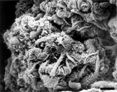 FIG. 6 SEM of cyst with glomerular tuft showing the morphology of podocytes. Numerous fingerlike process are present on both the soma and the primary process. Bar = 44 μm.