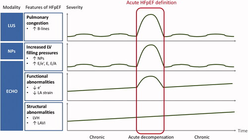 Figure 1. Proposal of an integrated approach to the diagnosis of acute heart failure with preserved ejection fraction (HFpEF) in patients with preserved EF and acute symptoms suggestive of HF. LUS: lung ultrasound; NPs: natriuretic peptides; ECHO: echocardiography; LV: left ventricle; LA: left atrium; LVH: left ventricular hypertrophy; LAVI: left atrial volume index.