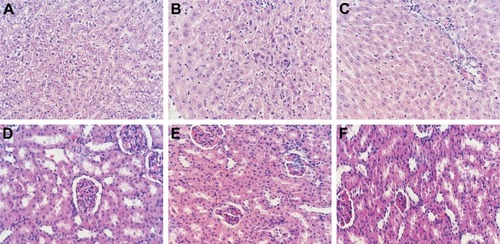 Figure 8 Typical histopathological images of major organs of sarcoma 180 tumor-bearing mice (magnification ×400).