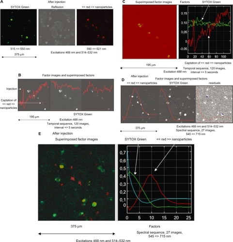 Figure 3 Case of temporal and spectral observations of iron nanoparticles conjugated with Texas Red injected in a culture of untreated murine cardiac HL1-NB cells counterstained with SYTOX Green in which emissions are collected through band-pass filters. A) Regular mode through band-pass filters after injection. B) The emission is then collected in the temporal mode in a long-pass-filter and processed by means of FAMIS. A stable emission corresponding to SYTOX Green and an emission uptake corresponding to red nanoparticles are visualized to localize nanoparticles in cell compartments. C) Superimposition in true color of the factor image. In some cells, the presence of a high signal emphasizes the fact that nanoparticles accumulate inside cytoplasm. D) Spectral mode through 10 nm band-pass filters. Investigation by means of FAMIS. A green emission (535 nm) corresponding to SYTOX Green in the first factor image and a red emission (610 nm) corresponding to red nanoparticles are visualized in the second factor image. Nanoparticles are either captured or not by the cells. E) Superimposition in true color of these factor images is performed to localize nanoparticles in cell compartments.