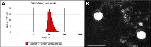 Figure 1 Size distribution (A) and TEM image (B) of IF-7-MNC. Scale bar =200 nm.Abbreviation: TEM, transmission electron microscopy.