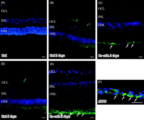 Figure 6. Immunofluorescent staining for complement protein 4 (green) in retinal tissue and ARPE cells; nuclei are counterstained with DAPI. Retinal nuclear layers (ONL, INL, and GCL) are indicated. C4-positive labeling is seen only in the ARPE cells (C, E, F). C4 labeling in the cultured ARPE cells is cytoplasmic, and C4 shows a more intense expression on the basal part of the ARPE cells (C, E, F) (indicated by arrows in F). Sparse C3-positive ganglion cells are obvious in the cultured control retinal tissue after 3 and 5 days of culture (indicated by * in the GCL). Scale bars, 20 μM.