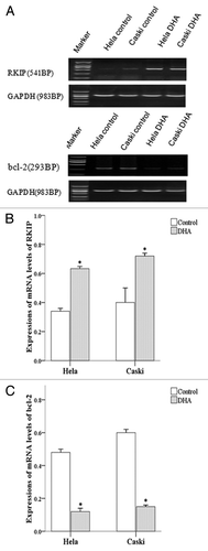 Figure 4. mRNA expression of RKIP and Bcl-2 in untreated and DHA-treated Hela and Caski cells. (A) Representative electrophoresis images; (B) mRNA expression of RKIP normalized to that of GAPDH; (C) mRNA expression of bcl-2 normalized to that of GAPDH. *P < 0.05 indicates a significant difference between control and DHA groups for each cell line.