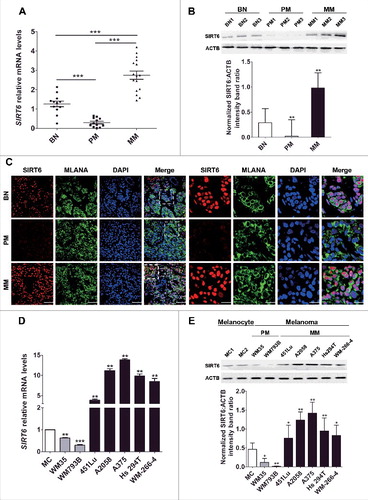 Figure 1. Aberrant SIRT6 expression in melanoma at different stages. (A) qRT-PCR analysis of SIRT6 mRNA levels in benign nevus tissues (left group, benign nevus, n = 12) and melanoma tissues at different stages (middle group, primary melanoma, n = 12; right group, metastatic melanoma, n = 16). BN, benign nevus; PM, primary melanoma; MM, metastatic melanoma. ***, P < 0.001. (B) Representative immunoblotting analysis of SIRT6 expression in the 3 groups as described previously (n = 3 per group). The lower panel is a densitometry analysis of 3 individual experiments. Data are presented as means ± SD. **, P < 0.01. (C) Representative immunofluorescence staining images of SIRT6 expression and localization in the 3 groups as described previously. Scale bars: 60 μm, left panel; 20 μm, right panel. (D) qRT-PCR analysis of SIRT6 mRNA level in normal human melanocytes (MCs) and melanoma cell lines at different stages. The relative SIRT6 mRNA abundance in MCs was designated as 1 (n = 3). Data are presented as means ± SD. **, P < 0.01; ***, P < 0.001. (E) Immunoblotting analysis of SIRT6 expression in MCs and melanoma cell lines at different stages. The lower panel is a densitometry analysis of 3 individual experiments. Data are presented as means ± SD. *, P< 0.05; **, P < 0.01. For (A, B, D and E), a Students' t test was used to calculate the P value.