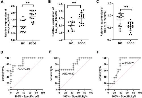 Figure 6 RT-qPCR analysis of hsa_circ_0075691, hsa_circ_0075692 and hsa_circ_0085997. (A–C) Validation of hsa_circ_0075691, hsa_circ_0075692 and hsa_circ_0085997 by RT-PCR (**p< 0.01). (D–F) The ROC curve of hsa_circ_0075691, hsa_circ_0075692 and hsa_circ_0085997 in distinguishing PCOS and normal controls.