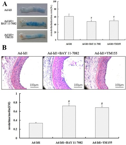 Figure 5 Blocking κB and Survivin attenuates the inhibitory effect of Ad-Id1 on restenosis of injured vessel.