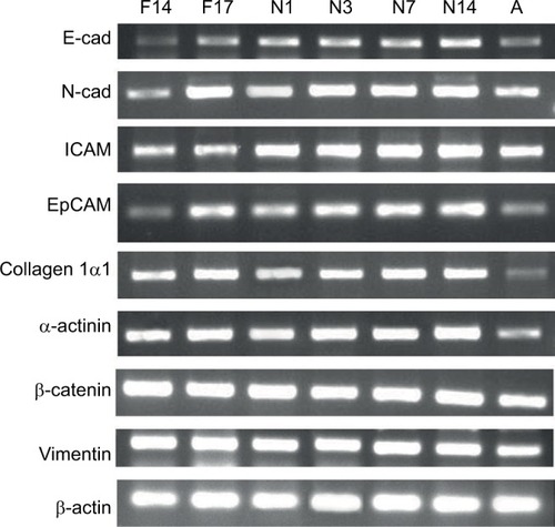 Figure 1 Expression of selected genes at different prenatal and postnatal stages observed through gel electrophoresis.