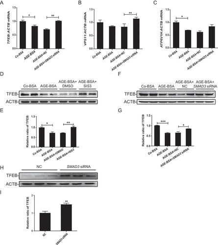 Figure 7. Inhibition of SMAD3 enhanced the expression of TFEB and its downstream genes under diabetic conditions. (A–C) Real-time PCR analysis of the mRNA levels of TFEB and its target genes VPS11 and ATP6V1H in HK-2 cells with or without SMAD3 siRNA knockdown followed by 30 μg/ml AGE-BSA or 30 μg/ml Co-BSA treatment for 24 h. (D–I) Western blot analysis of TFEB expression in HK-2 cells. Cells with or without SMAD3 inactivation by SIS3 and cells with or without SMAD3 silencing were exposed to AGE-BSA or Co-BSA for 24 h. Data represent the means ± SEM of at least 3 independent experiments. *P< 0.05, **P< 0.01, and ***P< 0.001