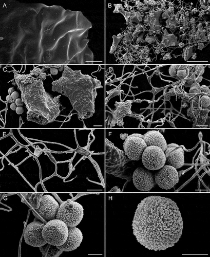Figure 5. Scanning electron micrographs of Diachea mitchellii (Lado 23139, MA-Fungi 91227). A. Smooth peridium. B. Fragmented columella. C. Detail of calcareous columella showing internal lime nodes. D. Reticulate capillitium. E. Detail of the capillitial threads. F–G. Cluster of spores. H. Spore. Bars: A = 20 µm; B = 100 µm; C–E = 10 µm; F–H = 5 µm.