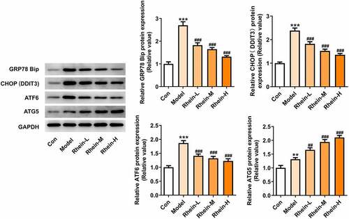 Figure 10. Effects of rhein on ER stress of adipose tissue in SD rats fed with HFD. western blot analysis of adipose tissue showing the expression of ERs-related protein and ATG5. The rats of different groups received the following treatment for six weeks, respectively. normal chow, high-fat diet (HFD) (D12492, 60% kcal%, Research Diets, USA), high-fat diet +Rhein-L (lose dose), high-fat diet (60% kcal%) + Rhein-M (medium dose), high-fat diet (60% kcal%) +Rhein-H (high dose). n = 6 rats/group. HFD, high-fat diet-fed rats. ***p < 0.05 versus control. ##p < 0.01, ###p < 0.001 versus HFD