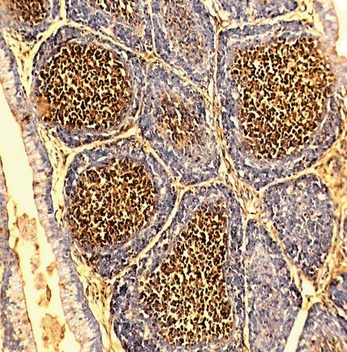 Figure 4.  Photomicrograph of bursa of Fabricius from representative progeny chick of a Group E hen fed OTA-contaminated feed at 3 mg OTA/kg feed for 21 days. IgG-bearing cells in medullary region shown here display positive DAB staining (DAB & Hematoxylin stain; 100× magnification).