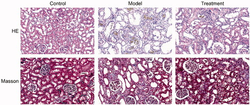 Figure 2. Curcumin alleviated histopathological changes in the kidneys of UAN rats. HE pathological staining and Masson staining. n = 10 rats per group. Scale bars = 30 μm.